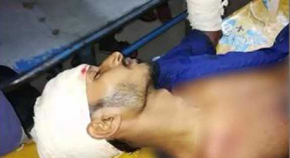 বোনকে উত্ত্যক্তের প্রতিবাদ করায় ভাইকে কোপালো বখাটে