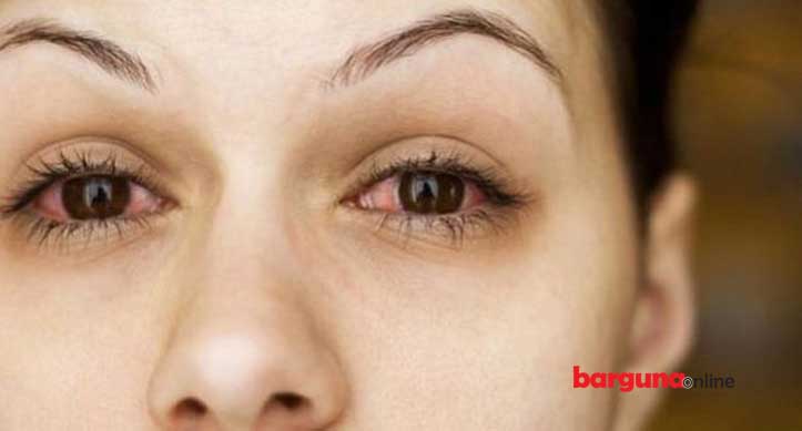 মানুষের চোখও কি করোনার টার্গেট?