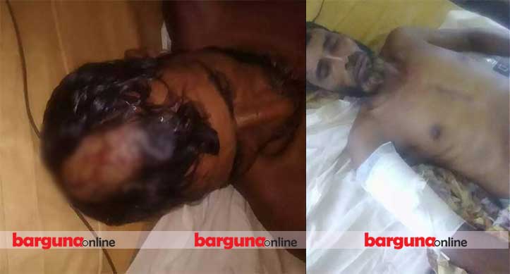 ছেলেকে মাদক বিক্রিতে রাজি করাতে না পেরে মা-বাবাকে কুপিয়ে জখম